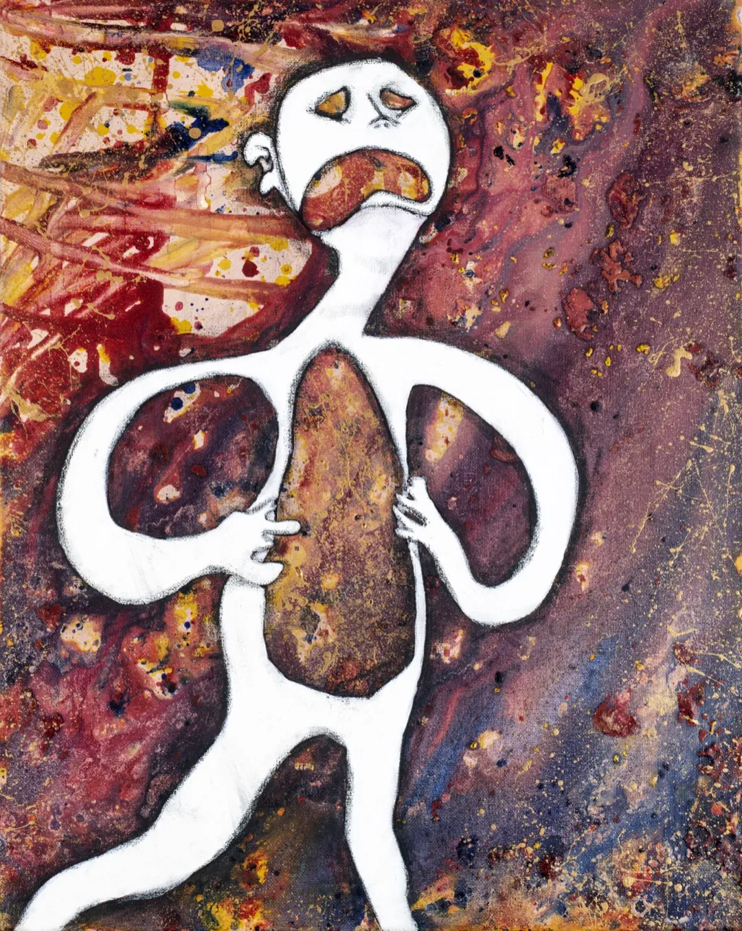 Agony of Bill